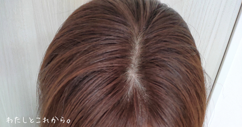カレントボディLED頭皮・頭髪ケアデバイスのafter写真