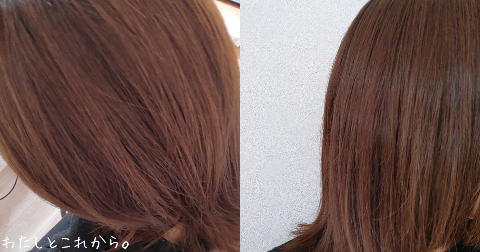 カレントボディLED頭皮・頭髪ケアデバイスのafter写真