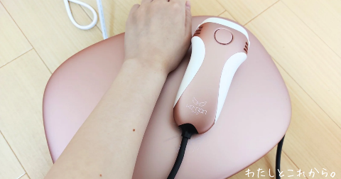 ケノンで脱毛完了した腕の写真