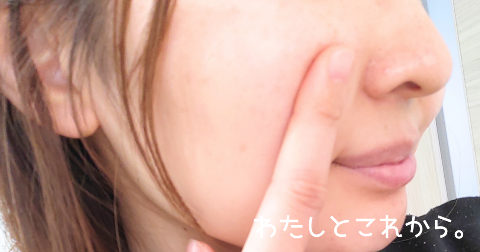 すっぴんのアフター写真