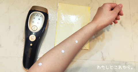 リムーザー脱毛器(Remozer 2Pro)