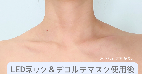 カレントボディLEDネック&デコルテマスク使用後の写真