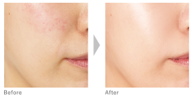 アクセーヌ スーパーサンシールド ブライトヴェール 01ピンクベージュ