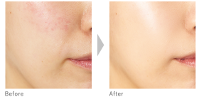 アクセーヌ スーパーサンシールド ブライトヴェール 02クリームベージュ