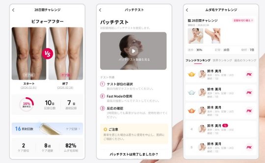 Ulike Air 10 Max IPL光美容器のAIアプリ