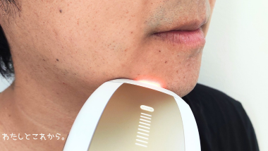 Ulike Air 10 Max IPL光美容器をヒゲに使っている写真